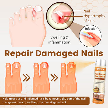 NATRAVOR® NailRescue Bee Venom Spray