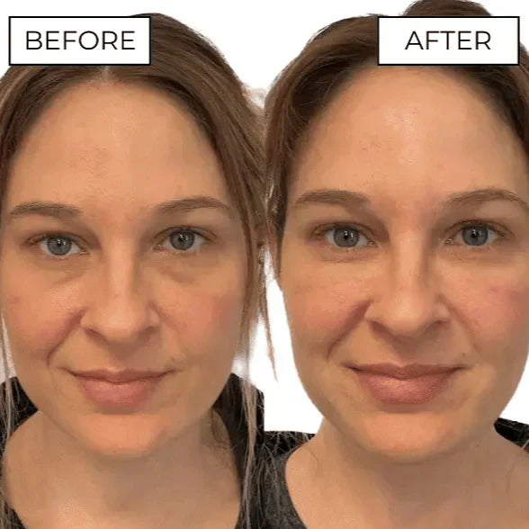 🎁Last day of the event: 80% discount!💥  Eye massager