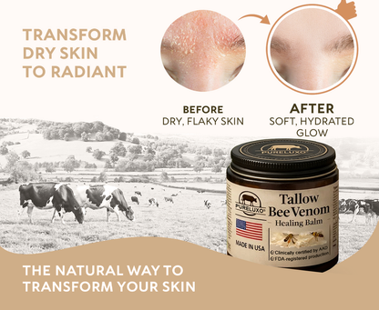 【70% OFF Ends Today】Pureluxo® 🐄Tallow Bee Venom Healing Balm（Targets Bumps, Wrinkles & Stressed Skin — Without Steroids）