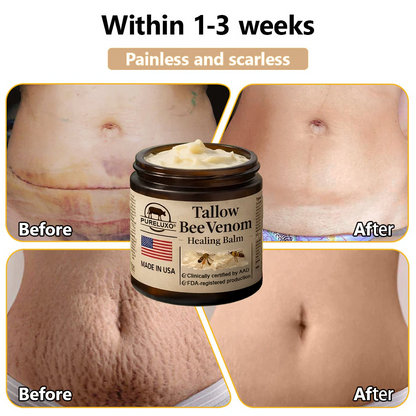【70% OFF Ends Today】Pureluxo® 🐄Tallow Bee Venom Healing Balm（Targets Bumps, Wrinkles & Stressed Skin — Without Steroids）