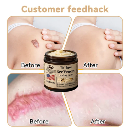 【70% OFF Ends Today】Pureluxo® 🐄Tallow Bee Venom Healing Balm（Targets Bumps, Wrinkles & Stressed Skin — Without Steroids）