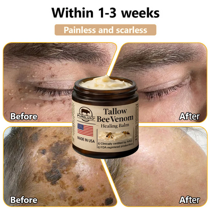 【70% OFF Ends Today】Pureluxo® 🐄Tallow Bee Venom Healing Balm（Targets Bumps, Wrinkles & Stressed Skin — Without Steroids）