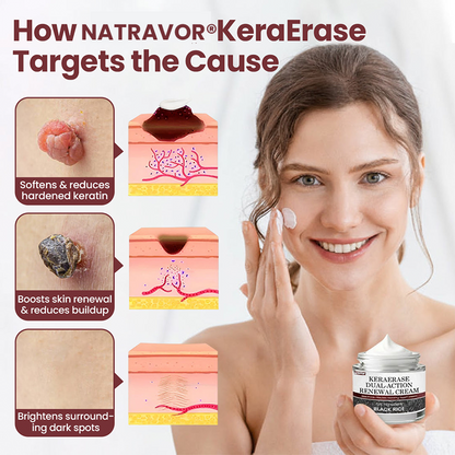 NATRAVOR®KeraErase Dual-Action Renewal Cream
