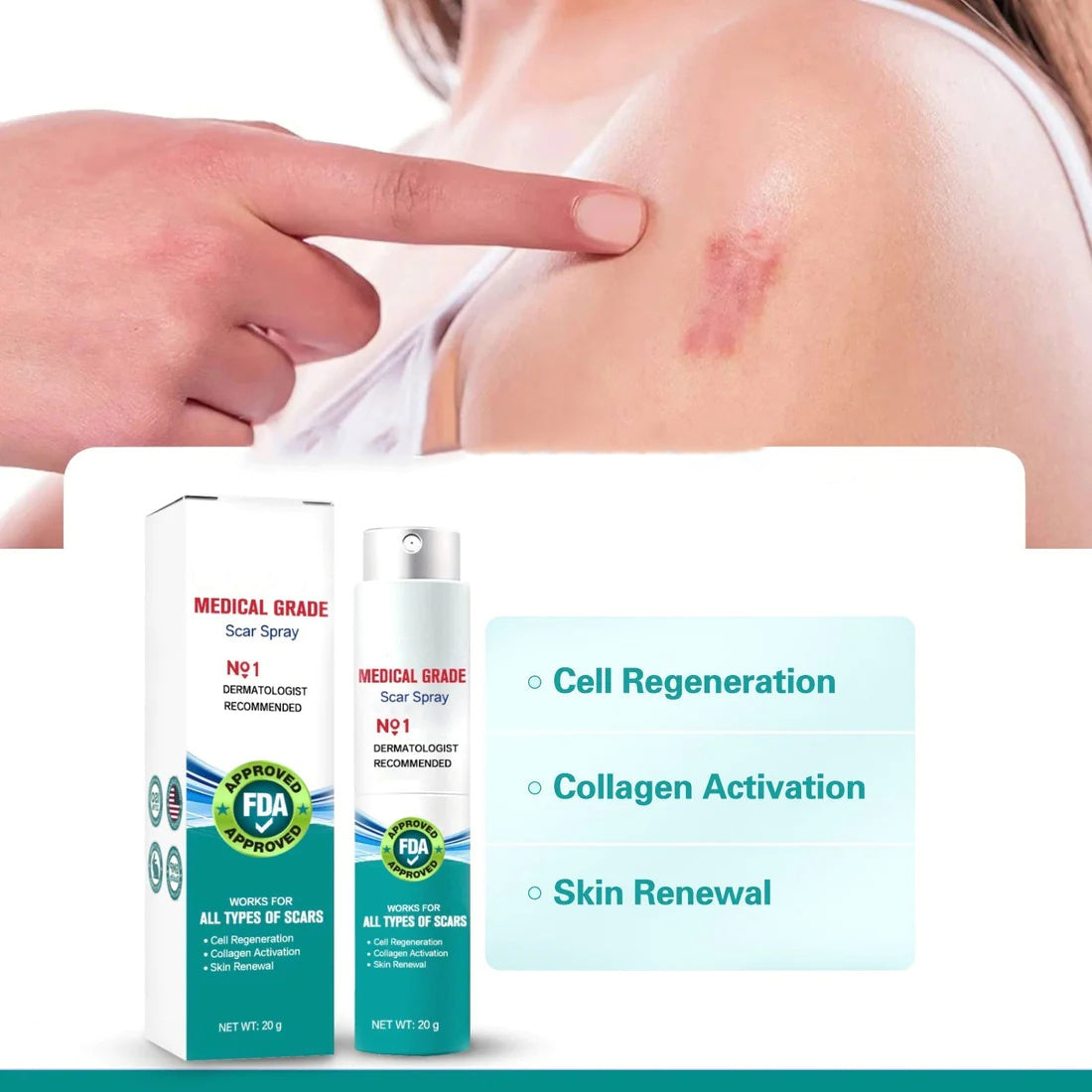 Scar Remove – Medical Grade Scar Spray(For example Acne Scars, Surgical Scars and Stretch Marks ⚡️⚡️⚡️)