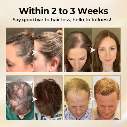 Diystar® CollagenGrow Peptides Hair Growth Spray