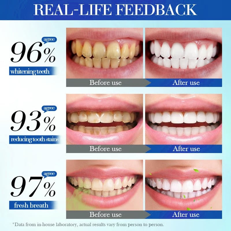 🔥2025 Upgraded Nano-Hydroxyapatite 7.5% Fluoride-Free Restorative Oral Care Toothpaste