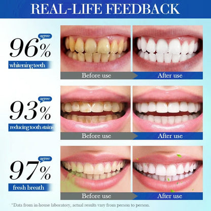 🔥2025 Upgraded Nano-Hydroxyapatite 7.5% Fluoride-Free Restorative Oral Care Toothpaste